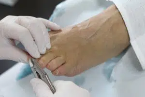 Behandeling: medische voetzorg Zorgvuldige behandeling van de voet